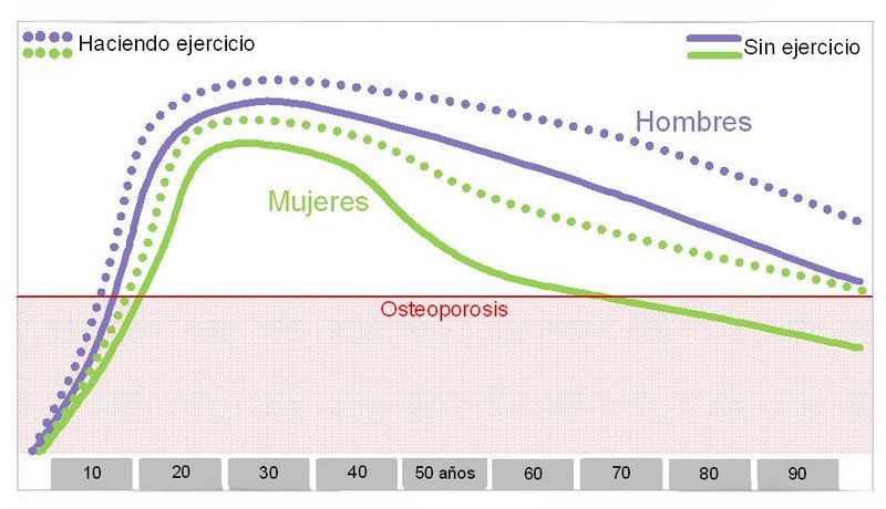 Gráfico Osteoporosis